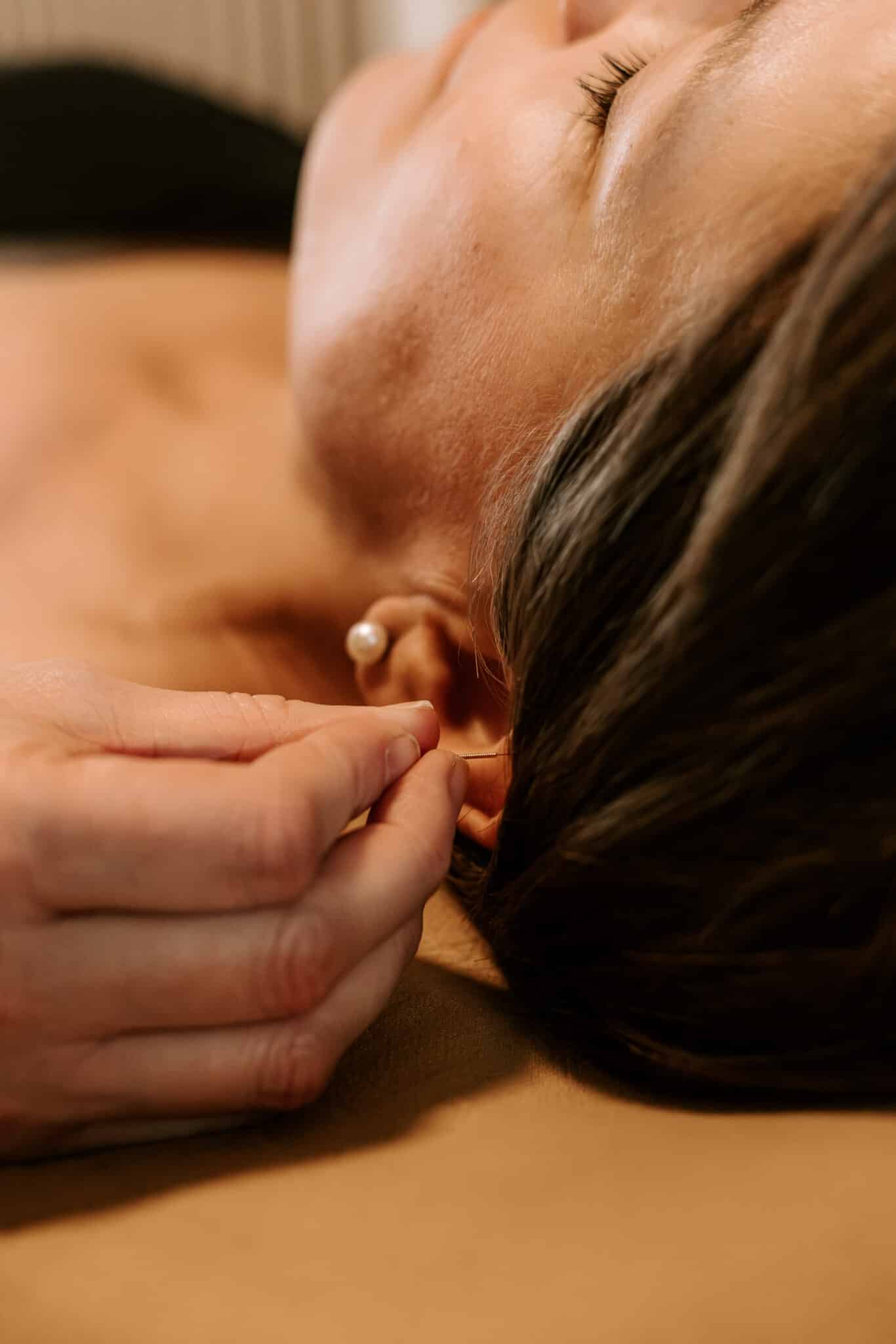 Øreakupunktur punkten Shenmen - giver